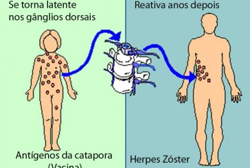 Vacina contra catapora aumenta casos de herpes-zóster